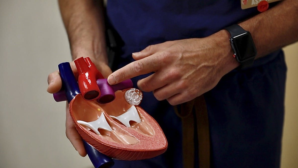 Dr. Josh Grant, a cardiologist at PeaceHealth Southwest Medical Center, demonstrates how PH occurs in and affects the heart using a model. Photo by Jacob Granneman